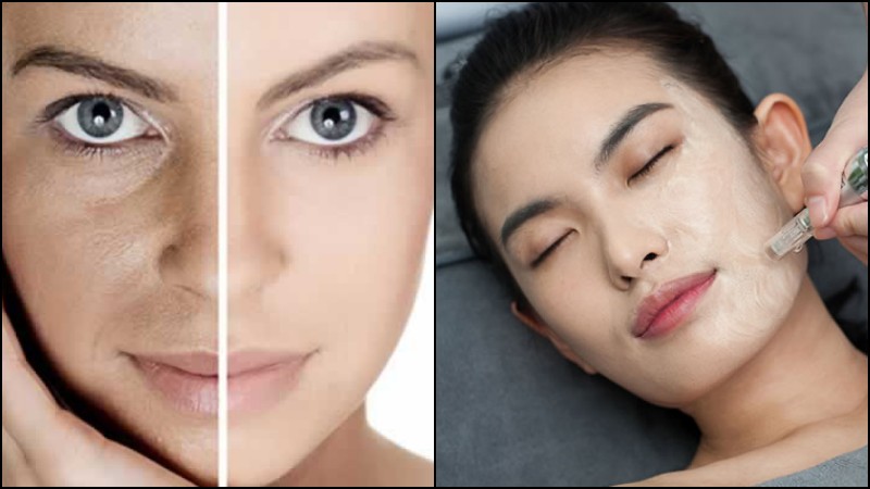 Bb glow – Korean facial treatment
