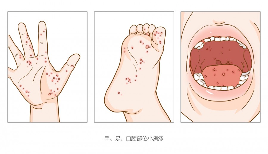 14 most contagious diseases and the ones that kill the most in japan
