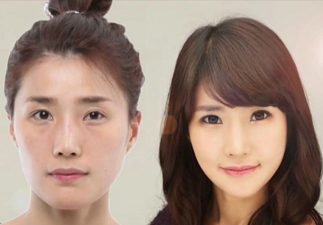 Koreans get plastic surgery as a gift?