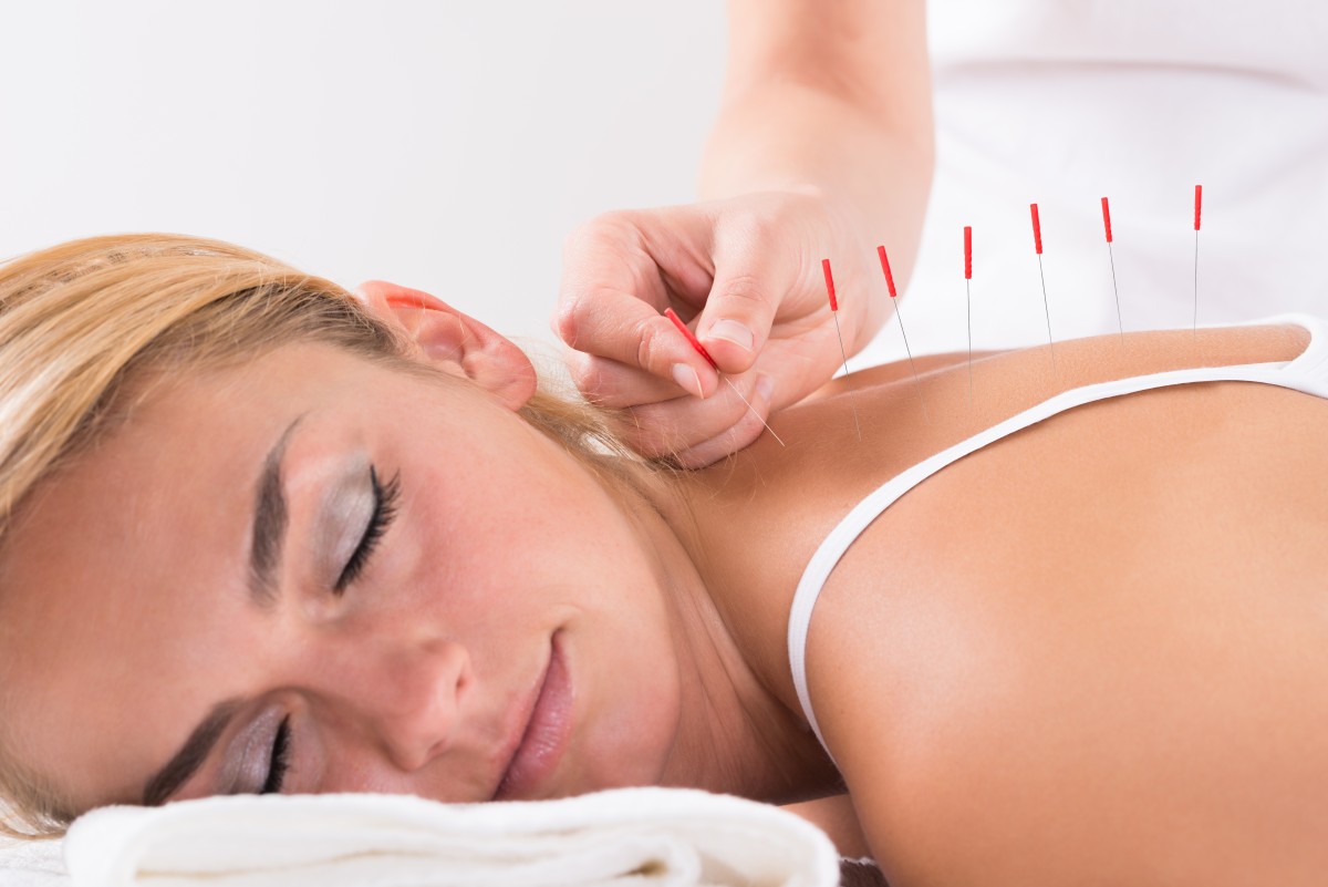 main effectuant une thérapie d'acupuncture