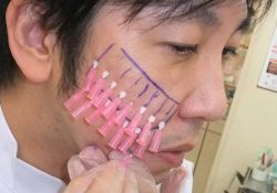 12 procedimentos estéticos que só existem no japão